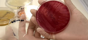 Estudo aponta milhões de bactérias e fungos em moscas formigas e baratas