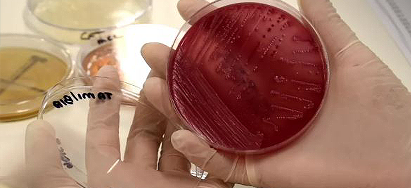 Estudo aponta milhões de bactérias e fungos em moscas formigas e baratas