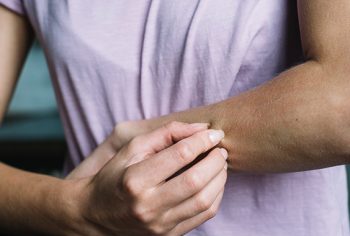 Produtos naturais para diminuir coceira