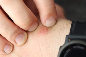 Infestação de pulgas